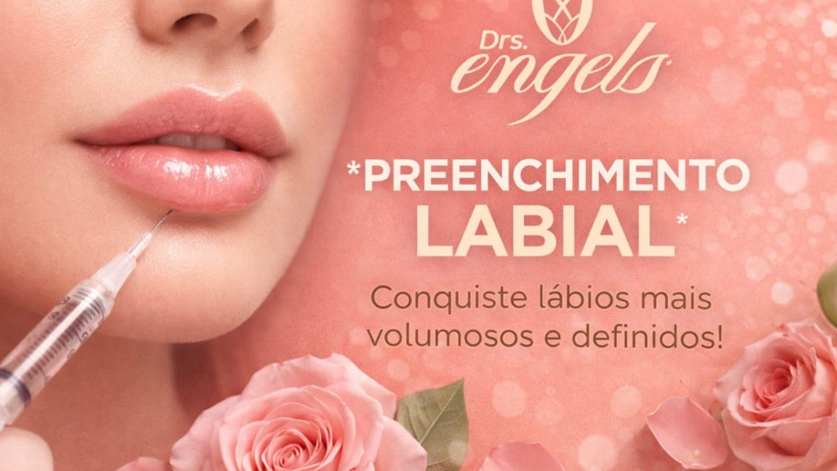Paciente após PREENCHIMENTO LABIAL com ácido hialurônico na Clínica DRS. Engels, Ponta Grossa — resultado natural e harmonização facial.