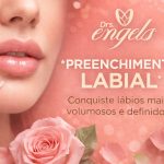 Paciente após PREENCHIMENTO LABIAL com ácido hialurônico na Clínica DRS. Engels, Ponta Grossa — resultado natural e harmonização facial.