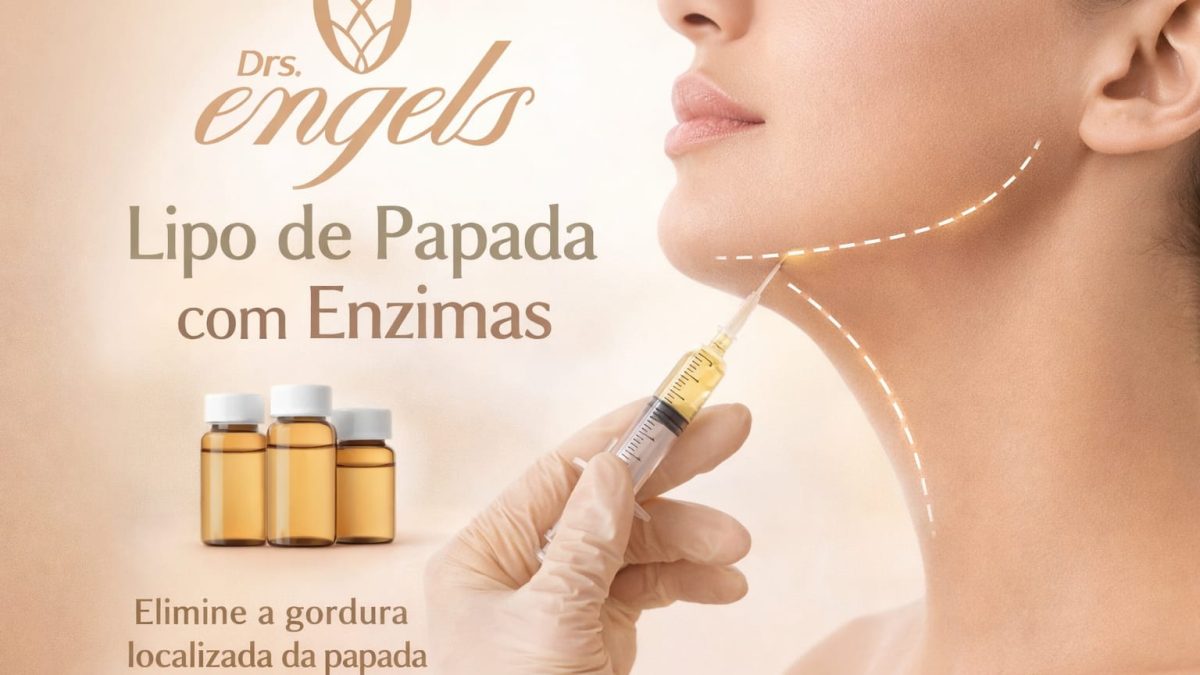 Paciente mostrando resultado de lipo de papada com enzimas, contorno de mandíbula mais definido — clínica DRS. Engels, Ponta Grossa/PR.