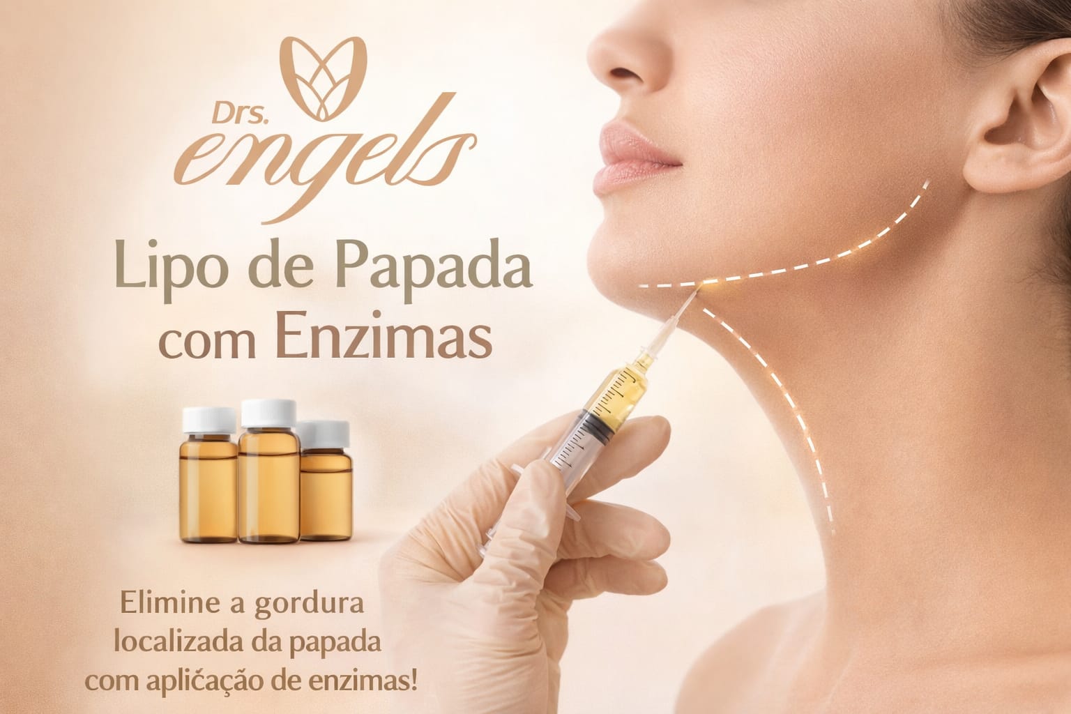 Paciente mostrando resultado de lipo de papada com enzimas, contorno de mandíbula mais definido — clínica DRS. Engels, Ponta Grossa/PR.