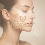 Paciente após harmonização facial feminina na DRS. Engels — redefinição de contornos, preenchimento e rejuvenescimento preservando naturalidade.