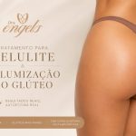 Profissional avaliando opções — qual o melhor volumizador de glúteo para resultado natural e seguro na Clínica Drs. Engels.